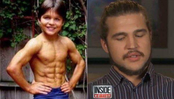 GALERÍA: Así luce ahora Richard Sandrak, el pequeño Hércules