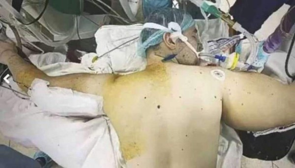 El rotundo cambio del 'Popeye' ruso: se sometió a una cirugía para salvar su vida