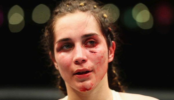 FOTOS: El antes y después de Verónica Macedo tras paliza en la UFC
