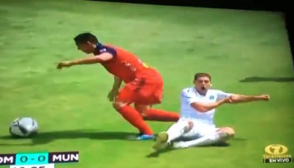 La espeluznante lesión de un jugador de Comunicaciones ante Municipal en Guatemala