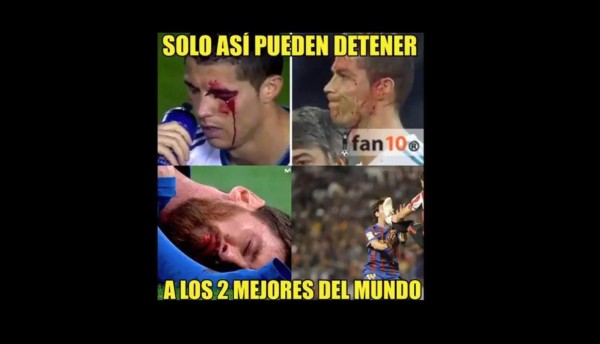 ¡VIRAL! Los memes de Cristiano Ronaldo por mirar su herida en el celular