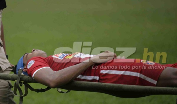 Sangre, abejas, chicas lindas y besos en las fotos curiosas de la fecha 7&nbsp;&nbsp;