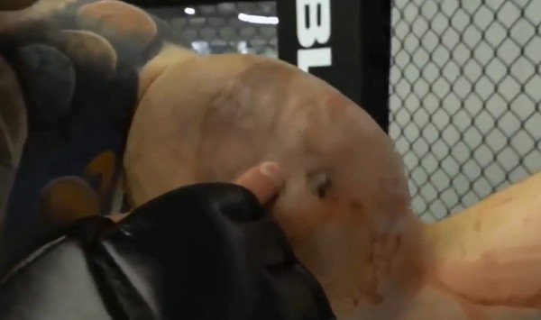 La fea lesión del Popeye ruso: le 'explotan' un brazo en plena pelea y anuncia que es el final