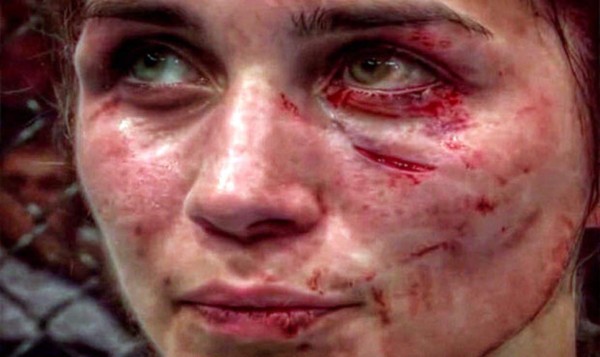 FOTOS: El antes y después de Verónica Macedo tras paliza en la UFC