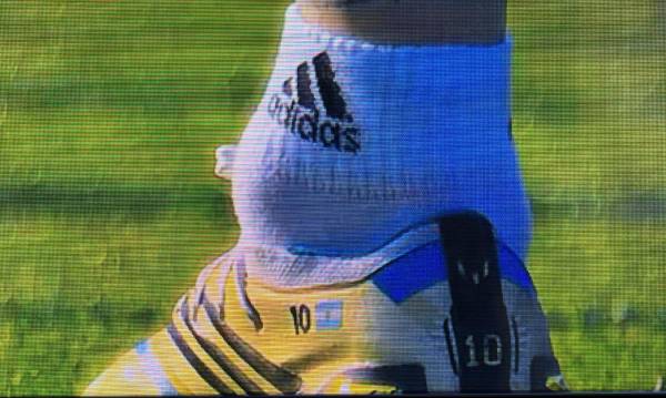 Alarma Messi: Así está el tobillo del argentino a pocas horas del debut ante Arabia Saudita en el Mundial de Qatar 2022