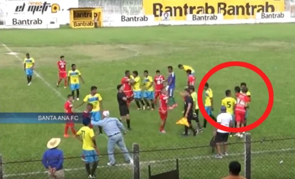 Futbolista agrede a rival y lo hace sangrar en la segunda división de Guatemala