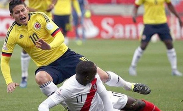 La NASA le crea una máquina a James Rodríguez para su rcuperación