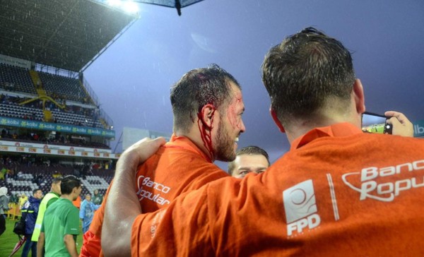 ¡Lamentable! Futbolista del Herediano fue agredido en celebración del título