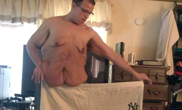 Jesse Shand, el hombre que no se rindió y bajó más de 300 libras