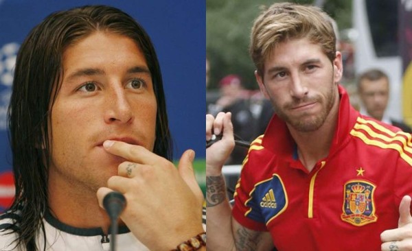 Futbolistas que recurrieron al bisturí para mejorar su apariencia física