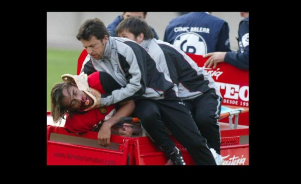 Uno más se une a la terrible lista: Las peores y escalofriantes lesiones en el fútbol
