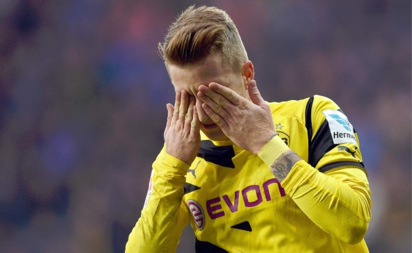 Marco Reus estará tres meses de baja por lesión