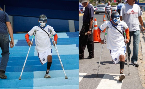 Olman, un ejemplo de garra y amor por Honduras