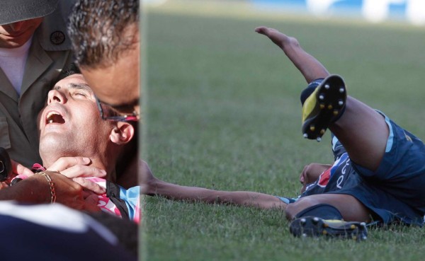 FOTOS: Los golpes y lesiones más brutales del fútbol hondureño