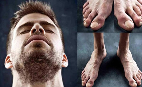 Los pies más feos de los futbolistas en el mundo