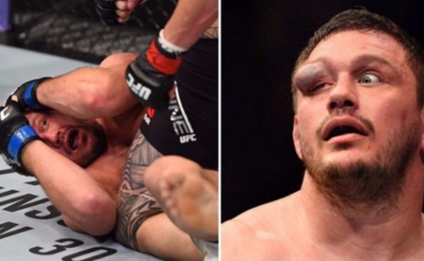 VIDEO: Novio de la luchadora Ronda Rousey casi le saca un ojo a un rival