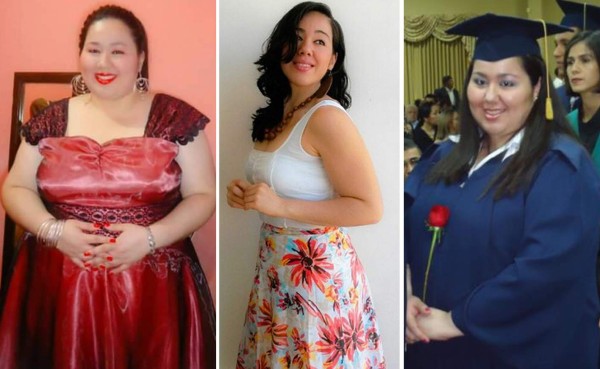 Fotos: Conocé a Silvia Bueso, la hondureña que perdió 230 libras para lucir bella