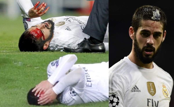 Isco recibió tremendo golpe, pero jugó 82 minutos