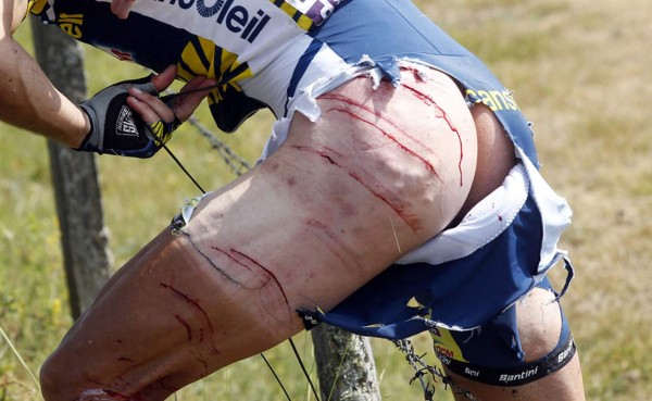 Las caídas más graciosas, pero muy peligrosas en el deporte