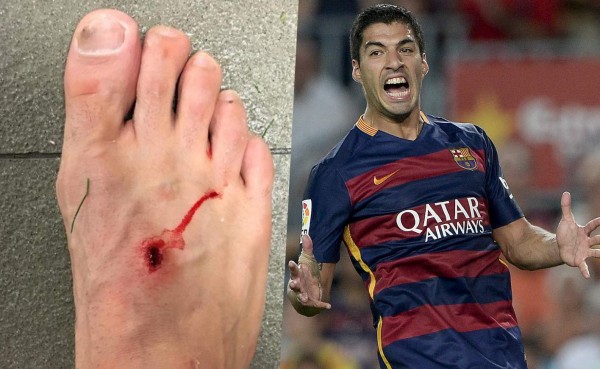 Filipe Luis se queja en las redes de pisotón de Suárez y este le responde