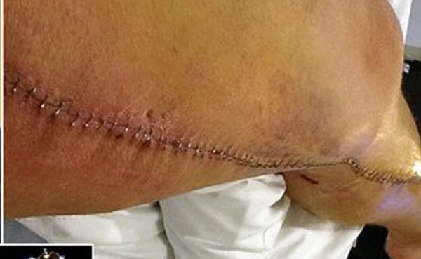 Las espeluznantes y temibles operaciones a los futbolistas