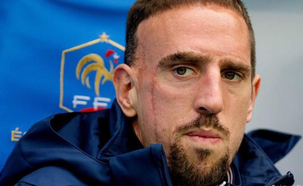 Frank Ribéry no viajará para apoyar a Francia ante Alemania