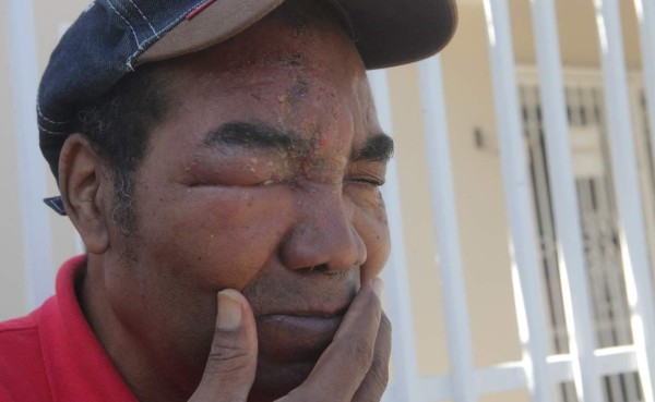 Vida entrega donativo a dos viejas glorias que hoy sufren