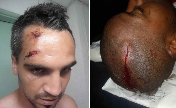 FOTOS: Así quedaron Yul Arzú y Portigliatti tras el Motagua-Juticalpa