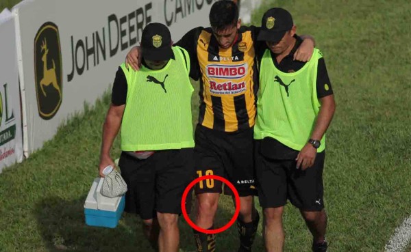 Luciano Ursino se pierde el resto del torneo con Real España