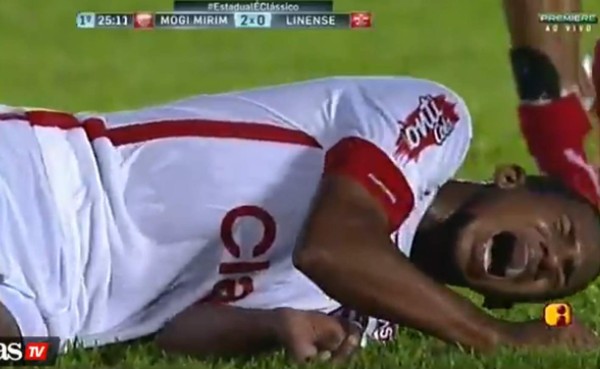 VIDEO: ¡De terror! Escalofriante lesión en el fútbol de Brasil