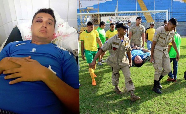 Portero de Liga Mayor de Honduras se lleva el susto de su vida