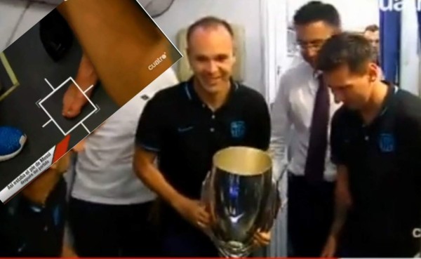 VIDEO: Las secuelas en el pie de Messi tras la Supercopa de Europa