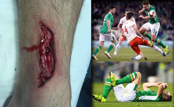 Lesión de Kevin Doyle figura entre una de las más escalofriantes del año