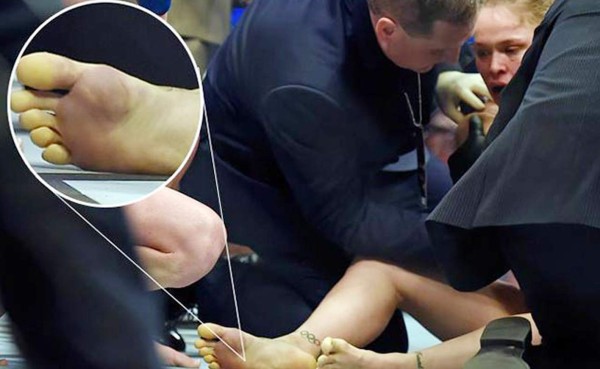 Los pies de Ronda Rousey revelan la causa de su derrota
