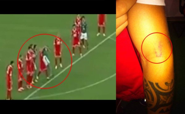 VIDEO: Jugador muerde a otro en juego por la Copa Italia