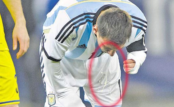 VIDEO: Rinosinusitis crónica, la causa de los vómitos de Messi