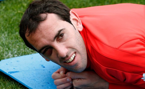 Godín sigue con su ojo hinchado después del encontronazo con Luis Suárez