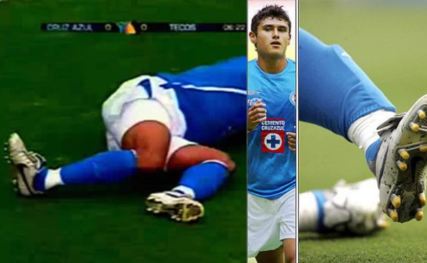 Las lesiones más escalofriantes del mundo del fútbol