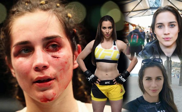 FOTOS: El antes y después de Verónica Macedo tras paliza en la UFC