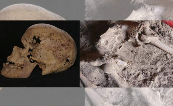 Identifican en Egipto el caso más antiguo de cáncer de pecho