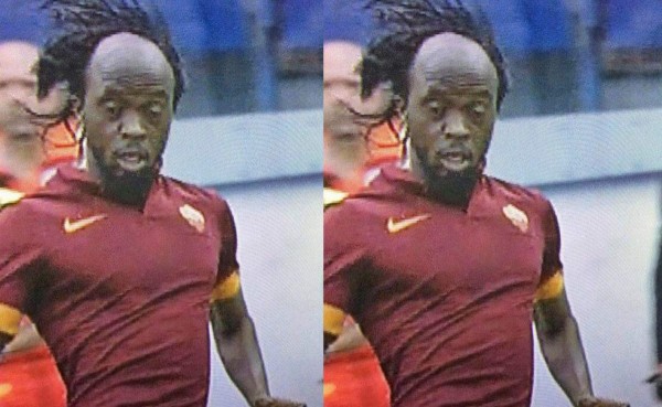 Gervinho y su calvicie, el secreto que salió a luz