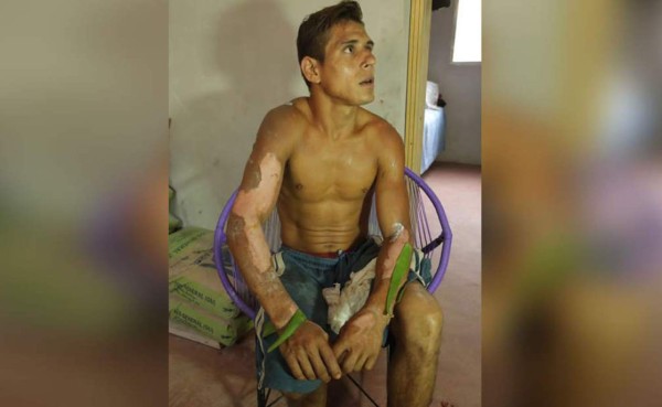 Adán Alberto Ríos Rodríguez cuenta que escuchó los gritos de la niña y sin pensarlo dos veces ingresó a la casa en llamas a sacarla. Empujé la puerta y vi que había una niña inconsciente y se estaba calcinando, según la temperatura que había', dijo. Foto laprensa.hn