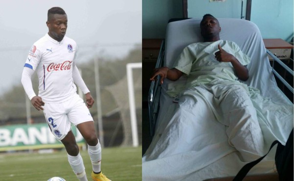 El lateral de Olimpia Kevin Álvarez fue operado por una hernia
