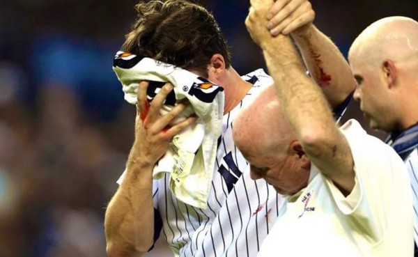 Novato de los Yankees recibe brutal pelotazo al rostro