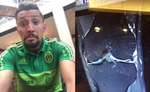 México pierde a Yasser Corona por el resto de la Copa Oro