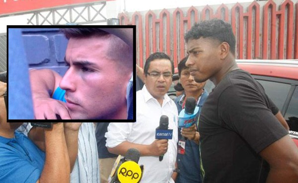 Barristas agreden en pleno entrenamiento a jugadores en Perú