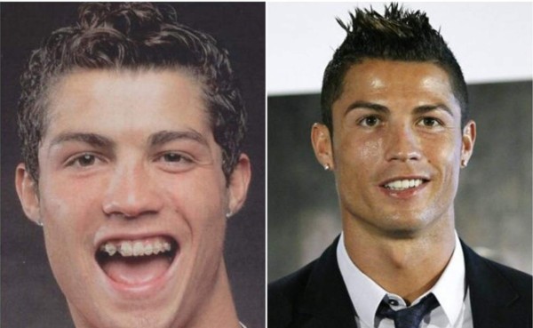 Futbolistas que recurrieron al bisturí para mejorar su apariencia física