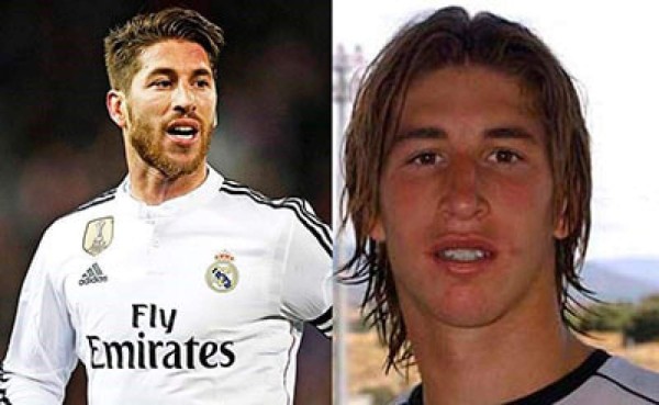 Futbolistas que se han hecho cirugía estética para verse mejor