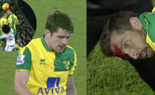 VIDEO: Brutal choque entre jugadores del Norwich City frente al Chelsea