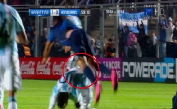 Esta fue la acción donde Messi impactó con Oliver Morazán de manera accidental y terminó lesionado.
